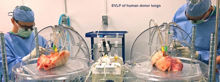 EVLP of Human Donor Lungs